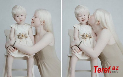Model dünyasını fəth edən albinos bacılar - Fotolar