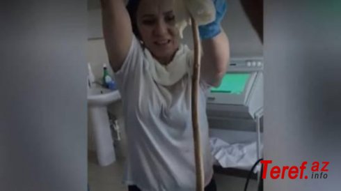Həkimlər qadının ağzından  iri ilanı çıxararkən dəhşətə gəldi...- VİDEO