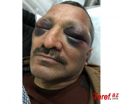 Tofiq Yaqublu: Möhkəm döydülər, sürüyüb avtomobilə atdılar, yolda yenə döydülər