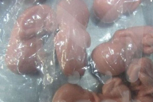 Rusiyada qadının çantasından yüzlərlə insan embrionu tapılıb - FOTO