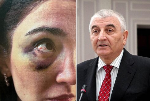DƏHŞƏT!!! Zənginlər də ağlayır: Məzahir Pənahovun oğlu Məhəmməd arvadını az qala öldürəcəkdi  FOTO