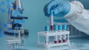 Azərbaycana bu xəstəlikləri aşkarlayan yeni testlər gətiriləcək