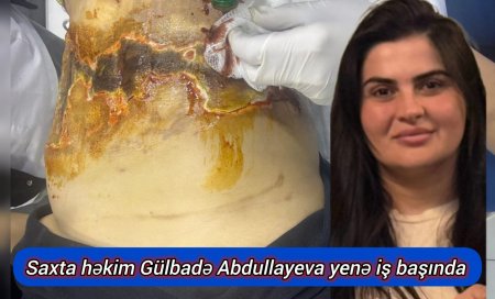 "Saxta həkim Gülbadə Abdullayevanın əməliyyatında yenə də zərərçəkənlər var" —