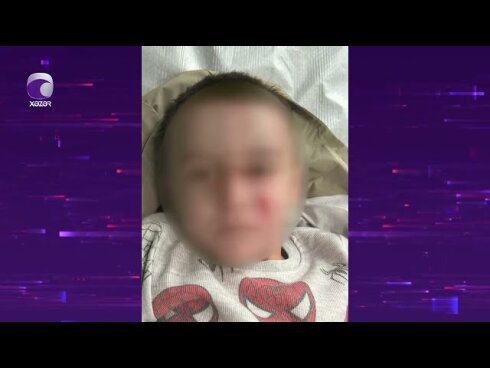 Bakıda bağçada uşaq ağır xəsarət aldı, təcili tibbi yardım çağırılmadı  VİDEO